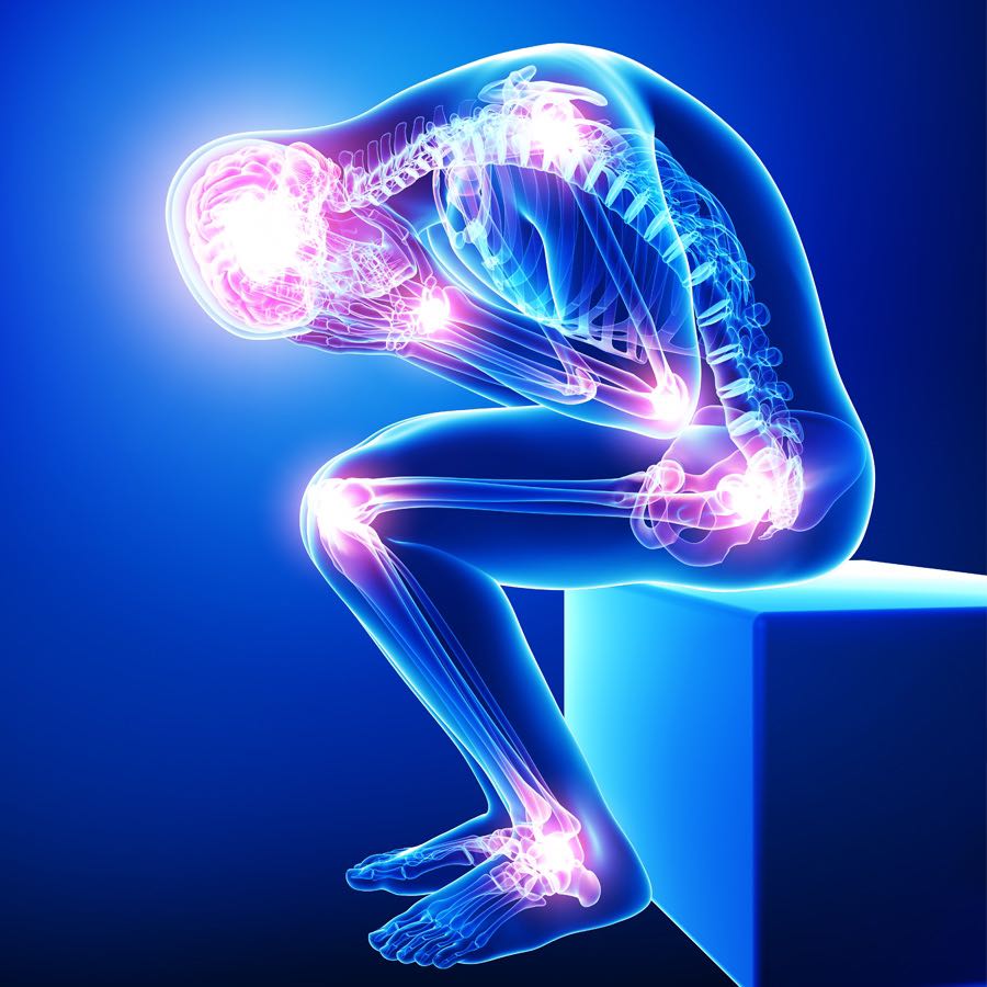 Chronic Pain icon